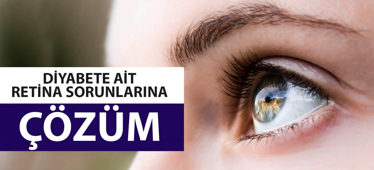 DİYABETE AİT RETİNA SORUNLARINA ÇÖZÜM