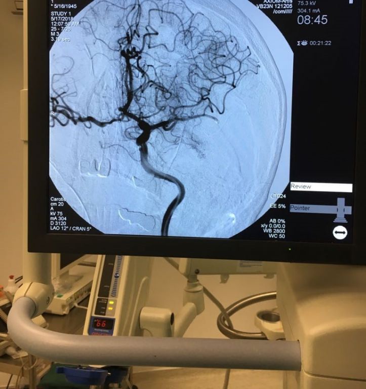 BOLU SAĞLIKTA İLKLERE İMZA ATMAYA DEVAM EDİYOR