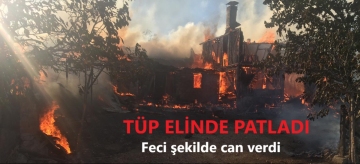 Tüp elinde patladı