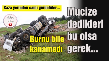 Bu kazada burnu bile kanamadı