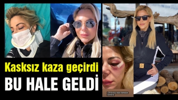 Ünlü sima Kartalkaya'da kasksız kaza geçirdi