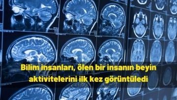 Bilim insanları, ölen bir insanın beyin aktivitelerini ilk kez görüntüledi