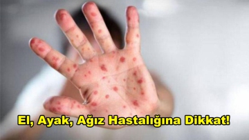 El, ayak, ağız hastalığına dikkat!
