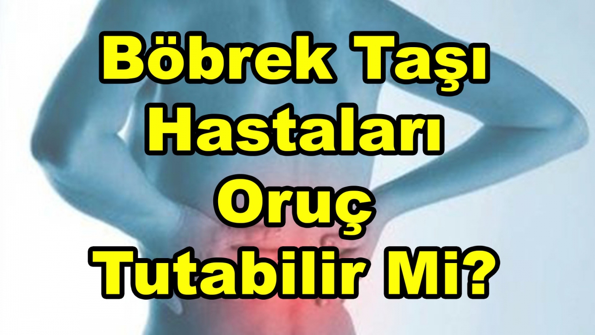 Böbrek Taşı Hastaları Oruç Tutabilir Mi ?
