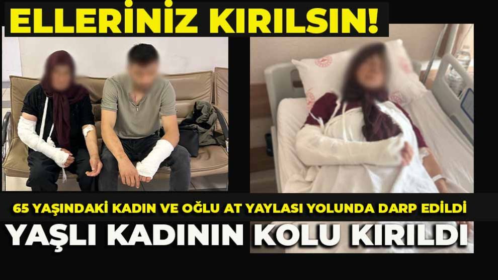 ELLERİNİZ KIRILSIN!  65 Yaşındaki Kadın ve Oğlu At Yaylası Yolunda Darp Edildi:  Yaşlı Kadının Kolu Kırıldı
