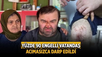 Yüzde 90 engelli vatandaş acımasızca darp edildi