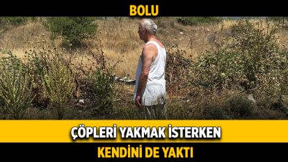 Çöpleri yakmak isterken kendini de yaktı