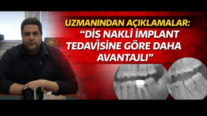 Uzmanından açıklamalar: “Diş Nakli İmplant Tedavisine Göre Daha Avantajlı”