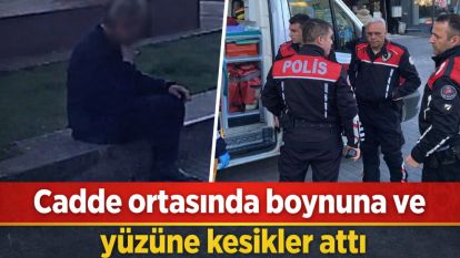 Cadde ortasında boynuna ve yüzüne kesikler attı