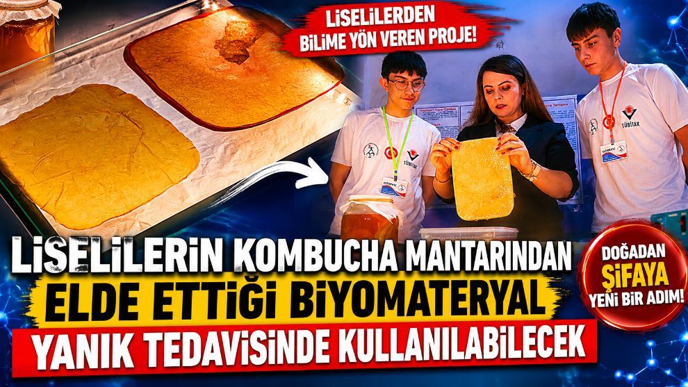 Liselilerin kombucha mantarından elde ettiği biyomateryal yanık tedavisinde kullanılabilecek
